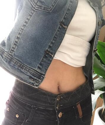 保定現(xiàn)代女子醫(yī)院整形美容中心做腰腹部吸脂怎么樣？附林秀蓮醫(yī)生案例效果圖