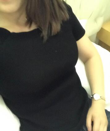 保定現(xiàn)代女子醫(yī)院整形美容中心做腰腹部吸脂怎么樣？附林秀蓮醫(yī)生案例效果圖