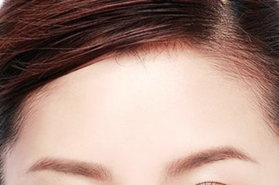 長(zhǎng)沙亞韓醫(yī)學(xué)美容醫(yī)院自體脂肪豐額頭