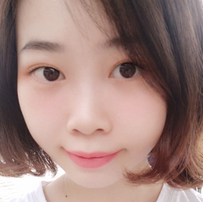 保定安卓貝拉醫(yī)療美容門(mén)診部孫大山醫(yī)生做雙眼皮+去眼袋怎么樣？附案例效果對(duì)比圖