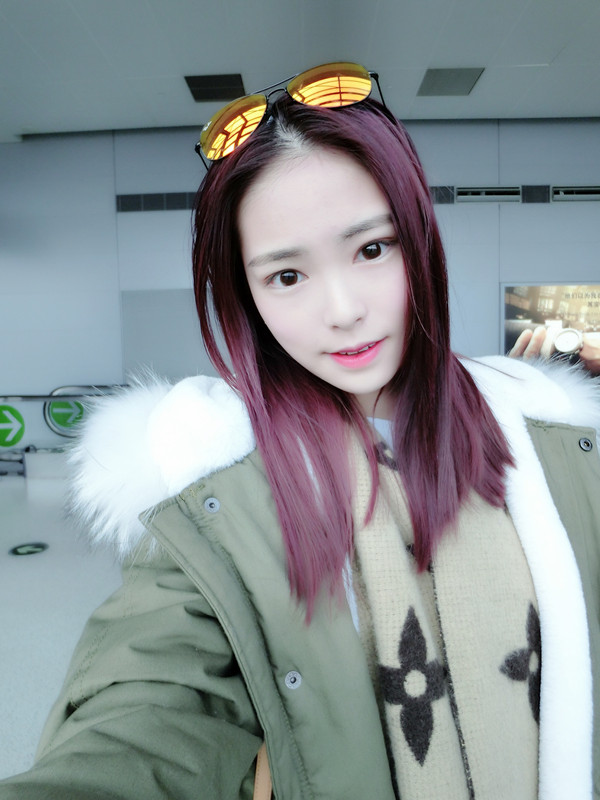 保定市第五醫(yī)院美容整形科做激光祛斑怎么樣？附單敬依醫(yī)生案例效果圖