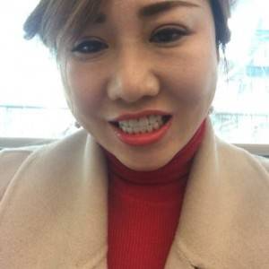 保定東陽口腔醫(yī)院趙晨醫(yī)生做瓷貼面怎么樣？附瓷貼面案例效果對比圖