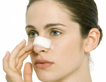 廈門華美名媛整形美容醫(yī)院自體軟骨隆鼻