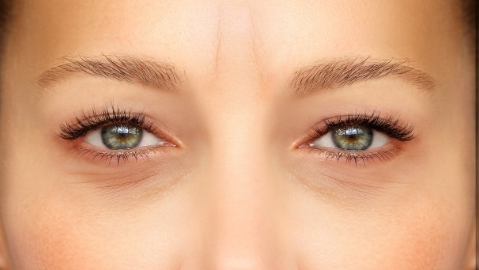 割眼袋要注意什么？