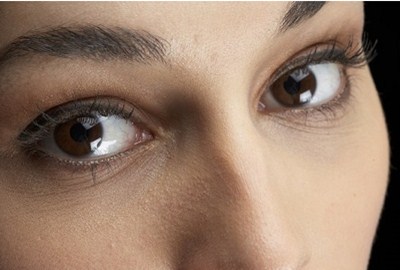 隆鼻假體能保持幾年？