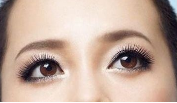 激光去黑眼圈多少錢？激光去黑眼圈效果好嗎？