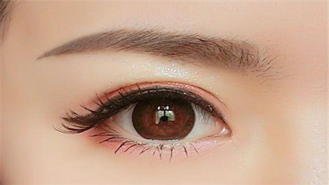 雙眼皮埋線是什么線？