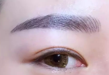 除皺去眼袋需要多少錢？價格貴嗎？