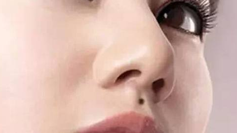 綜合隆鼻價(jià)格需要多少錢？?jī)r(jià)格貴嗎？