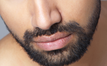 種植胡須大概多少錢？價錢貴嗎？