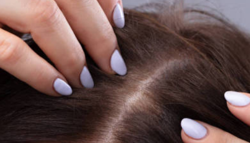 毛發(fā)種植手術(shù)多少錢？