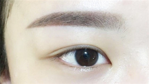 眼角修復(fù)手術(shù)多少錢？術(shù)后多久能恢復(fù)？