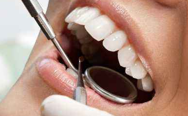 種植牙多少錢一顆？種植牙通常需要幾次完成？