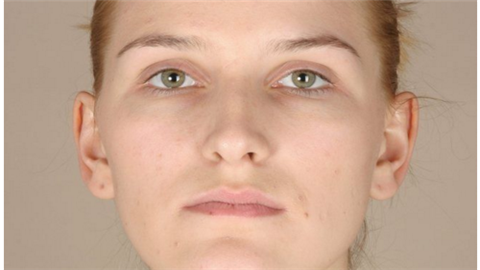 鐳射凈膚多少錢一次？