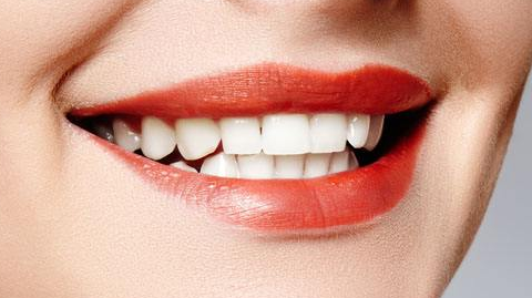 隱形托槽矯正的費(fèi)用是多少？