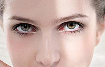 激光祛眼袋好還是手術(shù)祛眼袋好？做激光能維持幾年？