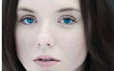 激光點痣留下的疤痕怎么辦？