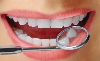 美容冠美白牙齒的費(fèi)用是多少？