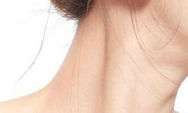 頸紋太深怎么辦?去除頸紋一般需要多少錢？