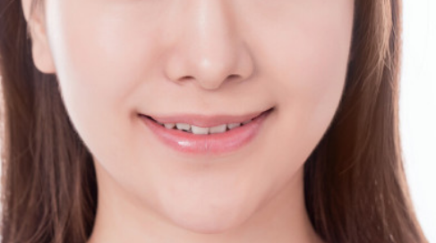 耳軟骨墊鼻尖一般可以維持多久？