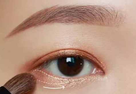 全切雙眼皮術(shù)后多久拆線？