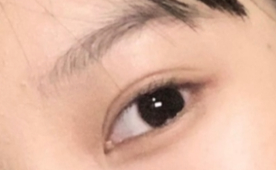 全切雙眼破的優(yōu)勢有哪些？