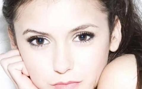 全切雙眼皮會(huì)留疤嗎？全切雙眼皮的優(yōu)勢(shì)有哪些？