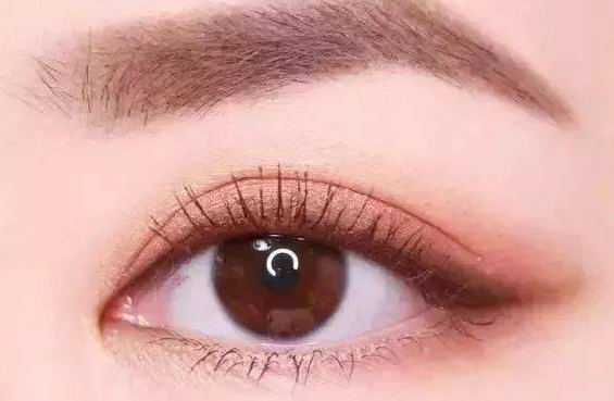 全切雙眼皮有什么副作用？