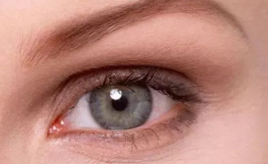 埋線雙眼皮能保持幾年？