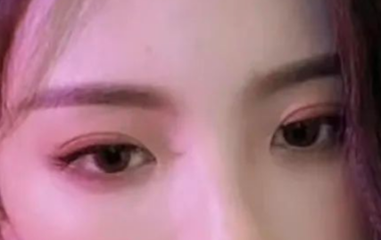 定點(diǎn)雙眼皮可以管多久？