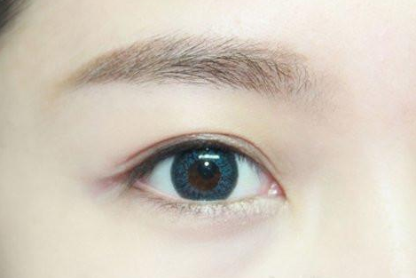 定點雙眼皮做一次需要多少錢？定點雙眼皮手術(shù)有哪些優(yōu)勢？