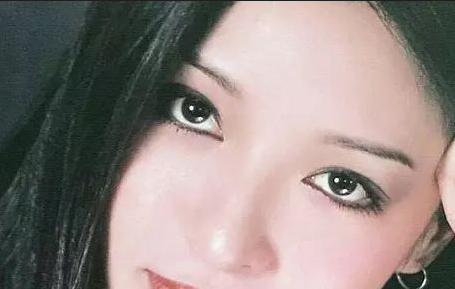 割雙眼皮會(huì)反彈嗎？