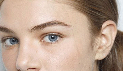 單眼皮割雙眼皮會留疤嗎？