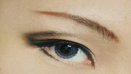 疤痕皮膚可以割雙眼皮嗎？40歲做埋線雙眼皮的效果好不好？