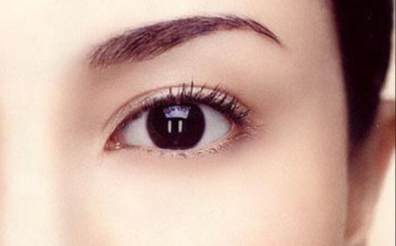 韓式開眼角多久恢復(fù)自然？韓式開眼角的特點(diǎn)有哪些？