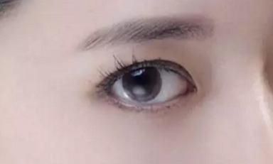 韓式開眼角的手術(shù)費(fèi)用是多少？