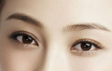 韓式開眼角手術(shù)的恢復(fù)時(shí)間？