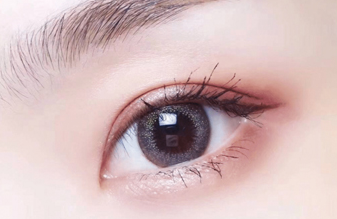 開(kāi)內(nèi)眼角大概需要多久恢復(fù)？