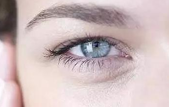 開內眼角的弊端有哪些？