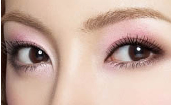 開內眼角疤痕怎么消除？