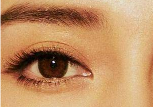 開(kāi)眼角的恢復(fù)是多久？