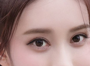 開眼角一般需要多少錢？