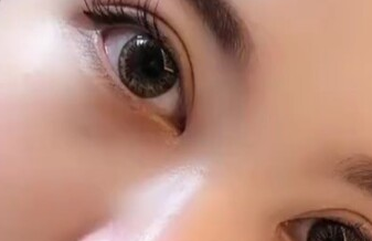 開眼角有沒有風險？開眼角有沒有副作用？