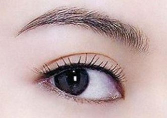 開眼角手術腫嗎？