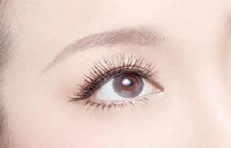 開眼角術的恢復期是多久？開眼角術的注意事項有哪些？