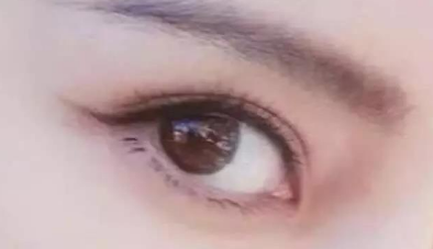 開眼角需要多久才能恢復(fù)？