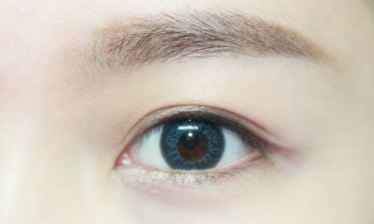 開眼角需要注意的事項(xiàng)有哪些？