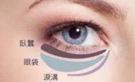 激光能祛除眼袋嗎？
