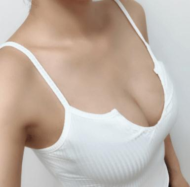 自體隆胸整形醫(yī)院哪家好？2022全國比較權(quán)威的隆胸醫(yī)院排名