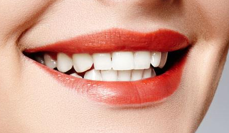 上海牙齒整形醫(yī)院哪家好？口碑牙科醫(yī)院一覽！